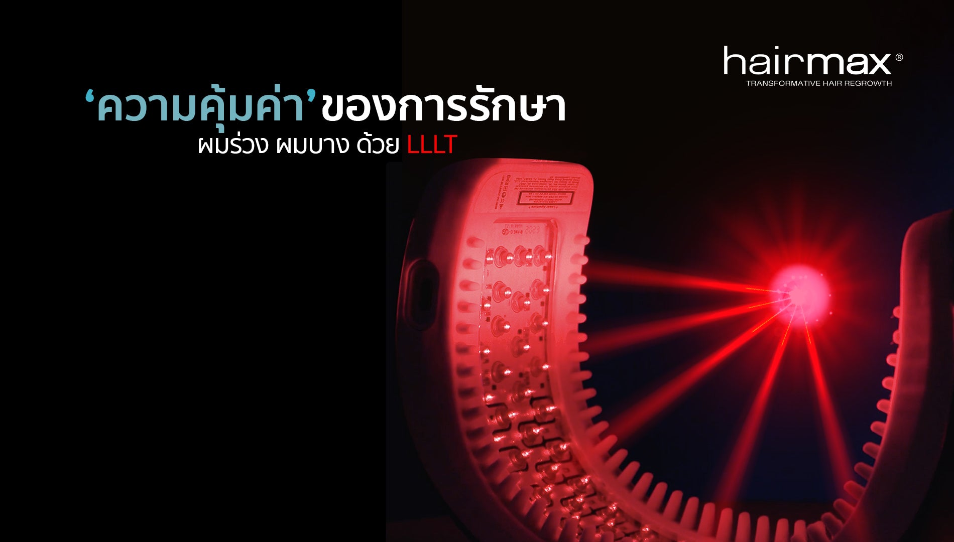 ความคุ้มค่าของการรักษาผมร่วง ผมบาง ด้วยเลเซอร์ LLLT